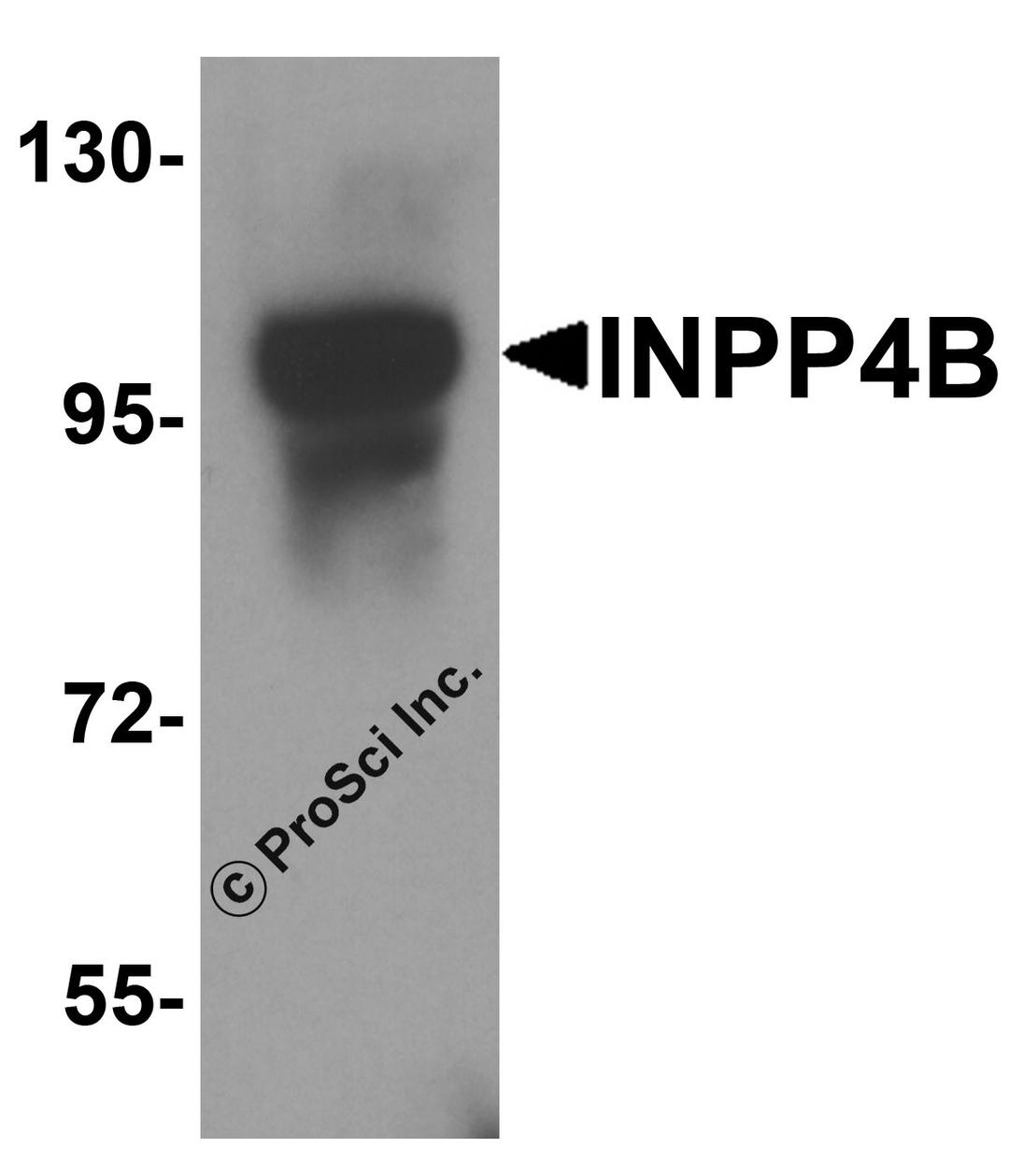 Western blot analysis of INPP4B in 3T3 cell lysate with INPP4B antibody at 1 &#956;g/ml.