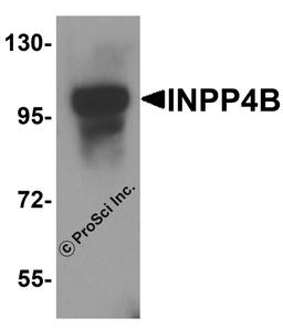 Western blot analysis of INPP4B in 3T3 cell lysate with INPP4B antibody at 1 μg/ml.