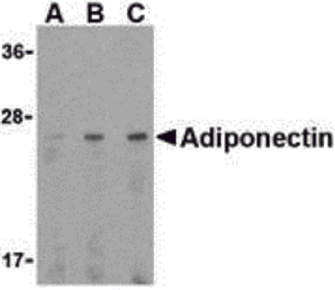 Western blot analysis of adiponectin in HL60 cell lysate with adiponectin antibody at (A) 0.5, (B) 1, and (C) 2 μg/mL.