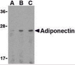 Western blot analysis of adiponectin in HL60 cell lysate with adiponectin antibody at (A) 0.5, (B) 1, and (C) 2 μg/mL.