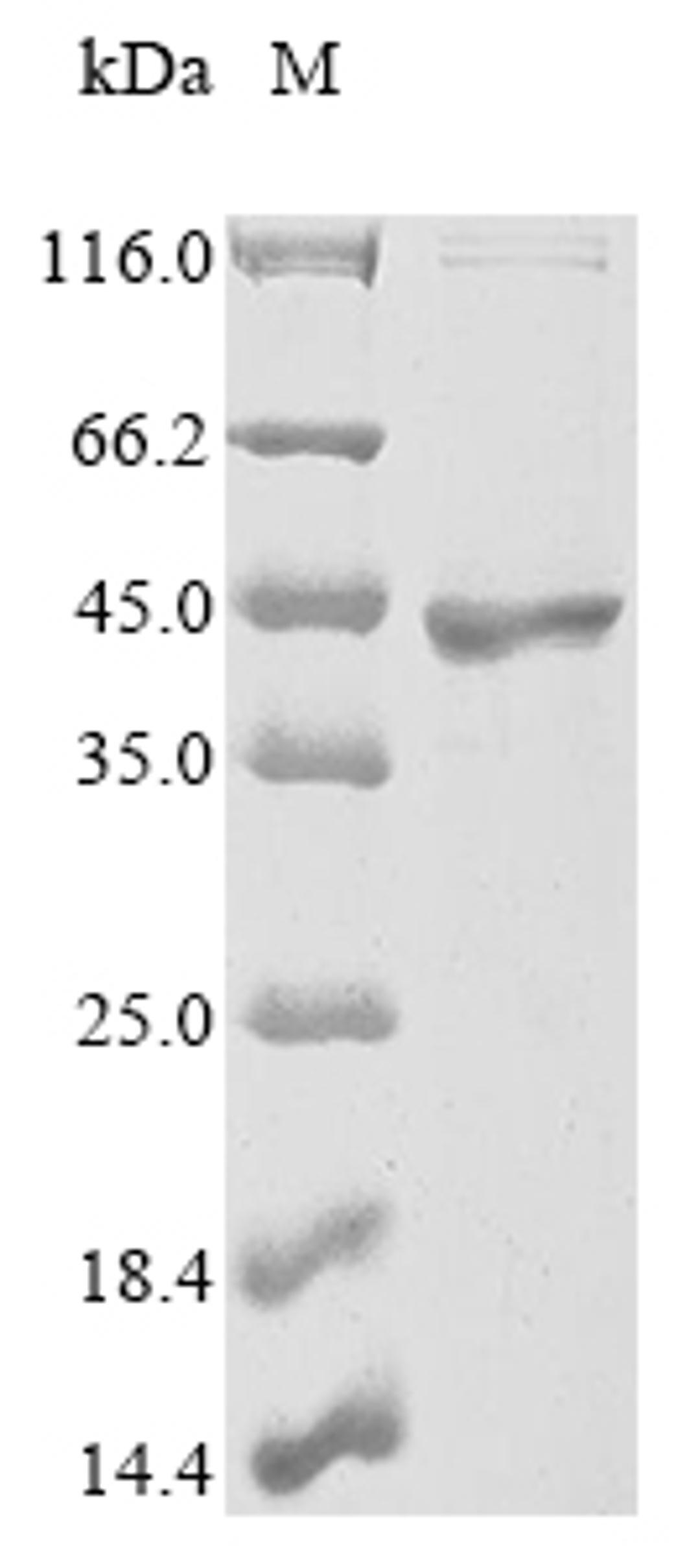 (Tris-Glycine gel) Discontinuous SDS-PAGE (reduced) with 5% enrichment gel and 15% separation gel.