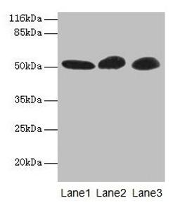 Western blot. All lanes: GDI2 antibody at 2µg/ml. Lane 1: Mouse brain tissue. Lane 2: HepG2 whole cell lysate. Lane 3: MCF-7 whole cell lysate. Secondary. Goat polyclonal to rabbit IgG at 1/10000 dilution. Predicted band size: 51, 46 kDa. Observed band size: 51 kDa