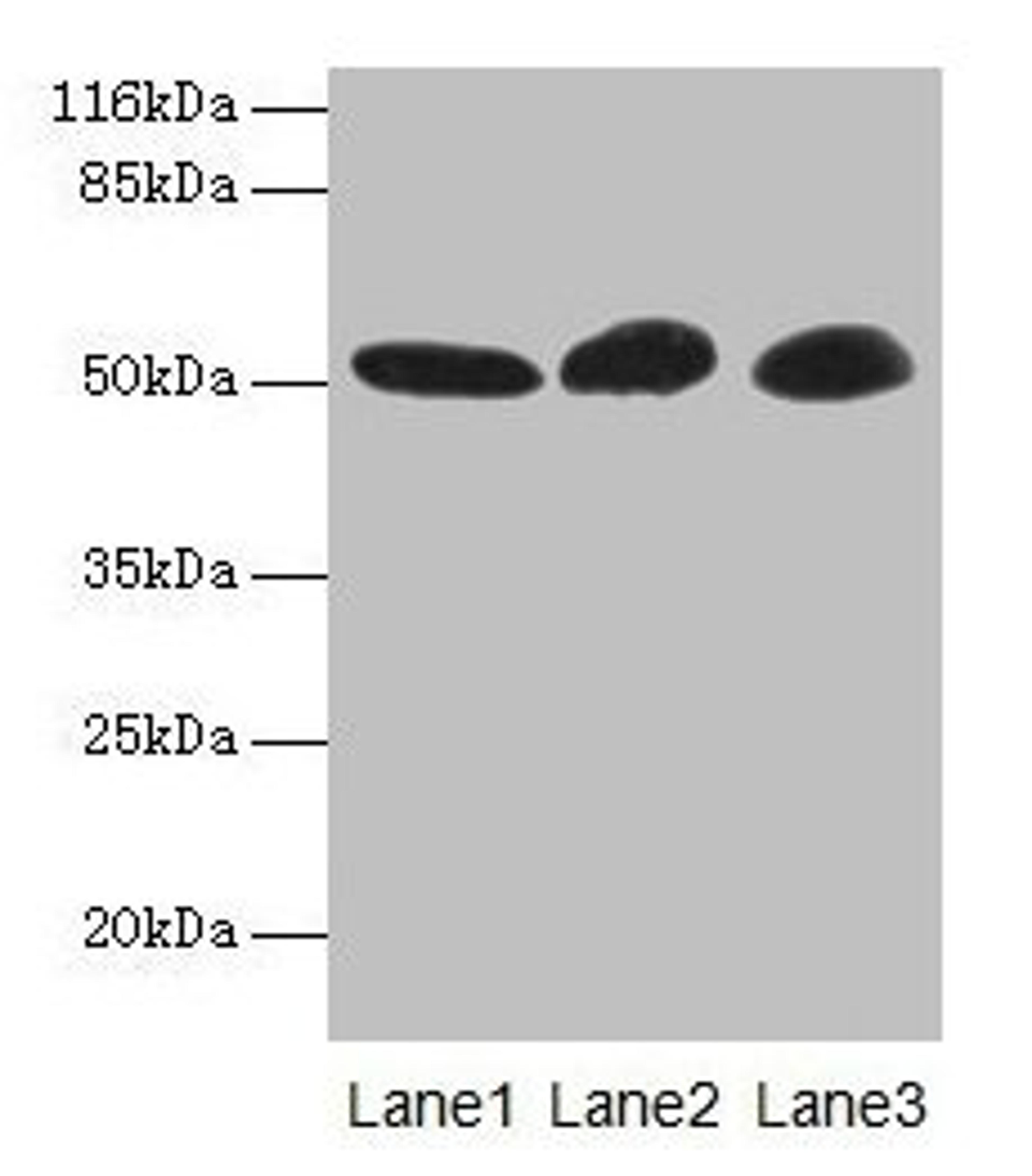 Western blot. All lanes: GDI2 antibody at 2µg/ml. Lane 1: Mouse brain tissue. Lane 2: HepG2 whole cell lysate. Lane 3: MCF-7 whole cell lysate. Secondary. Goat polyclonal to rabbit IgG at 1/10000 dilution. Predicted band size: 51, 46 kDa. Observed band size: 51 kDa
