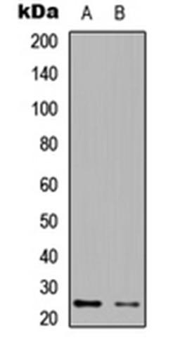 Western blot analysis of HEK293T (Lane 1), NIH3T3 (Lane 2) whole cell lysates using EIF4E3 antibody