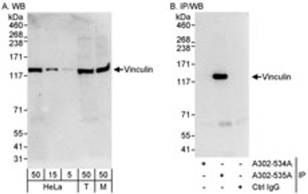 Detection of human and mouse Vinculin by western blot (h&m) and immunoprecipitation (h).