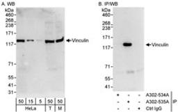 Detection of human and mouse Vinculin by western blot (h&m) and immunoprecipitation (h).