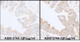 Detection of human expndtw-6 INPPL1/SHIP2 by immunohistochemistry.