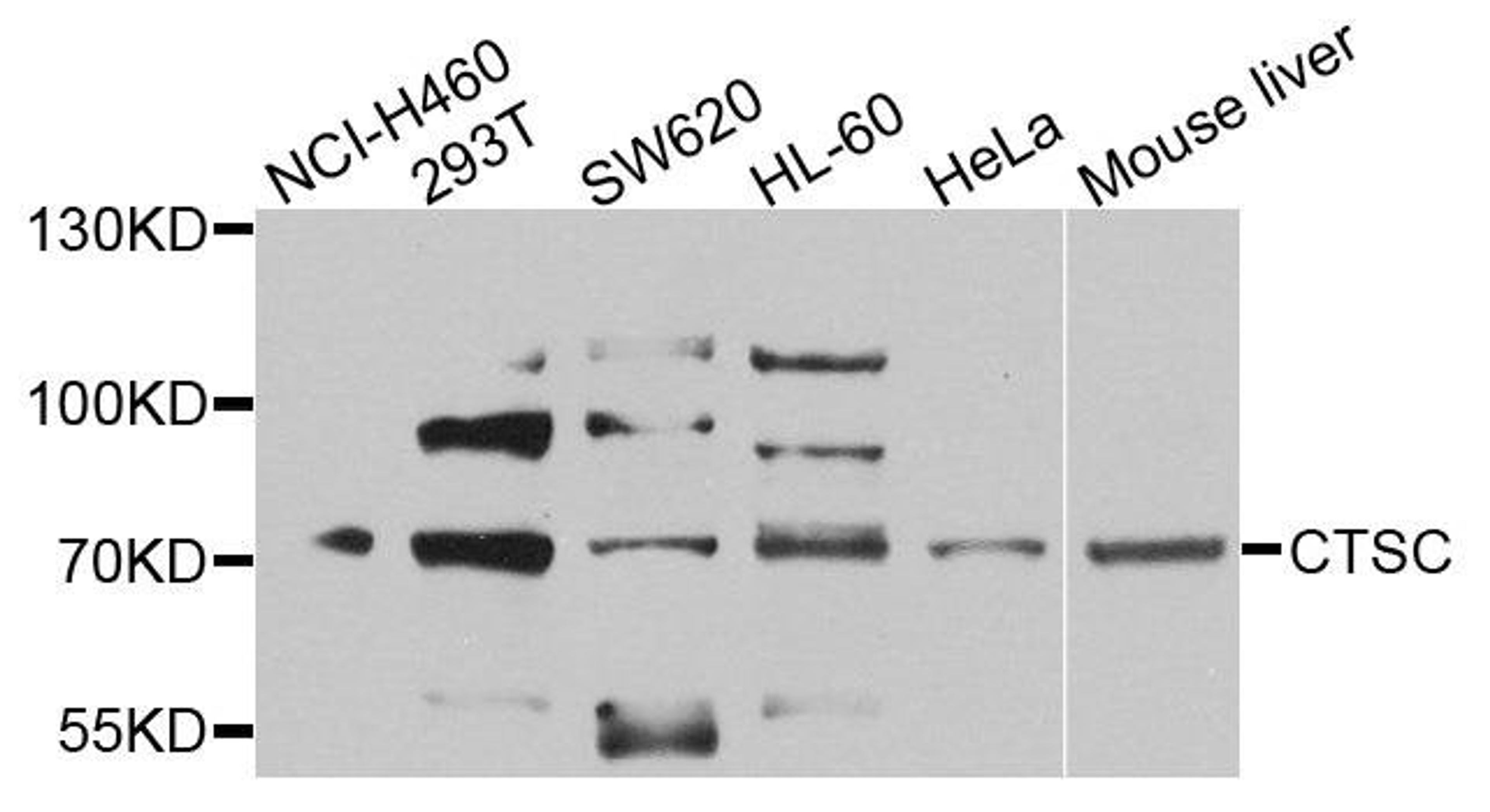 Western blot analysis of extracts of various cells using CTSC antibody