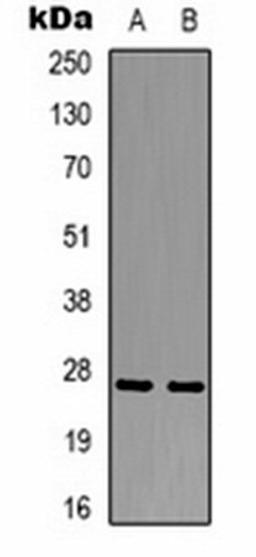 Western blot analysis of mouse spleen (Lane 1), rat spleen (Lane 2) whole cell lysates using Swiprosin-2 antibody