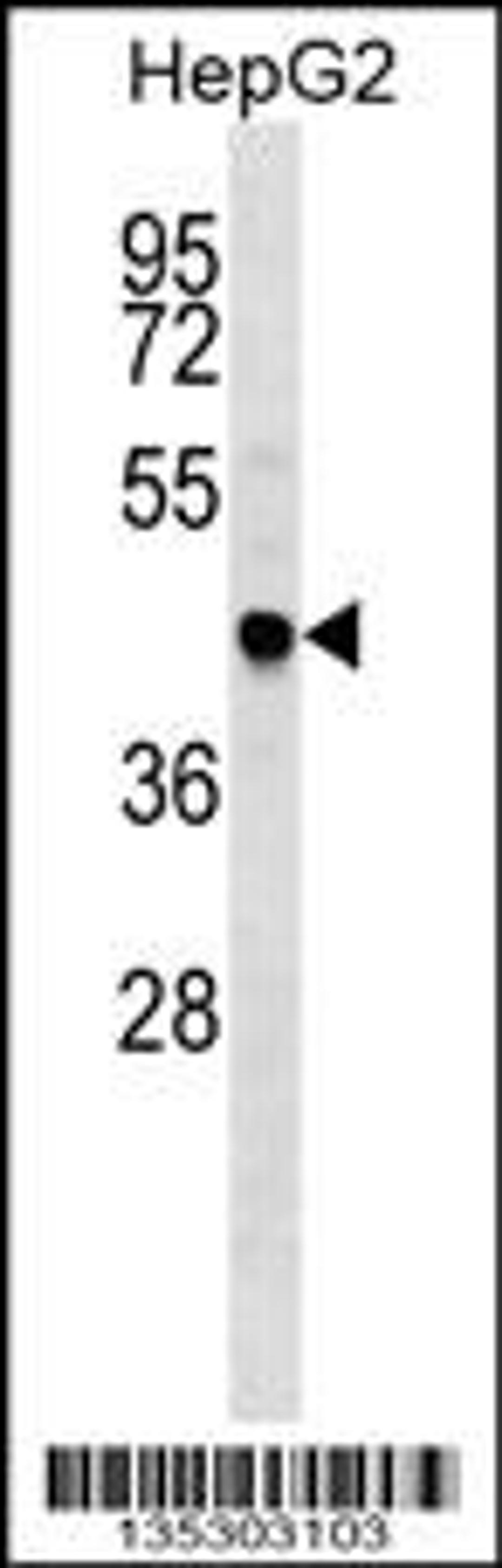 Western blot analysis in HepG2 cell line lysates (35ug/lane).