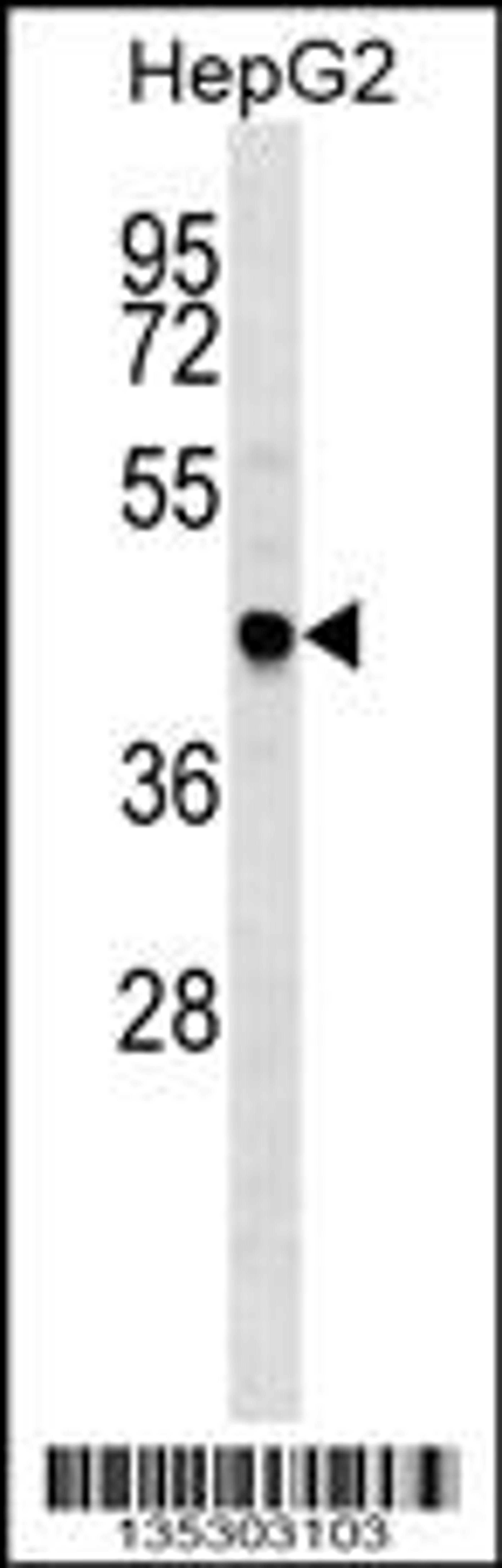 Western blot analysis in HepG2 cell line lysates (35ug/lane).