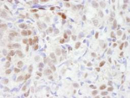 Detection of human TBLR1 by immunohistochemistry.