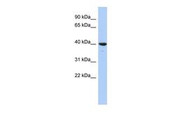 Antibody used in WB on Human HepG2 cells at 0.2-1 ug/ml.