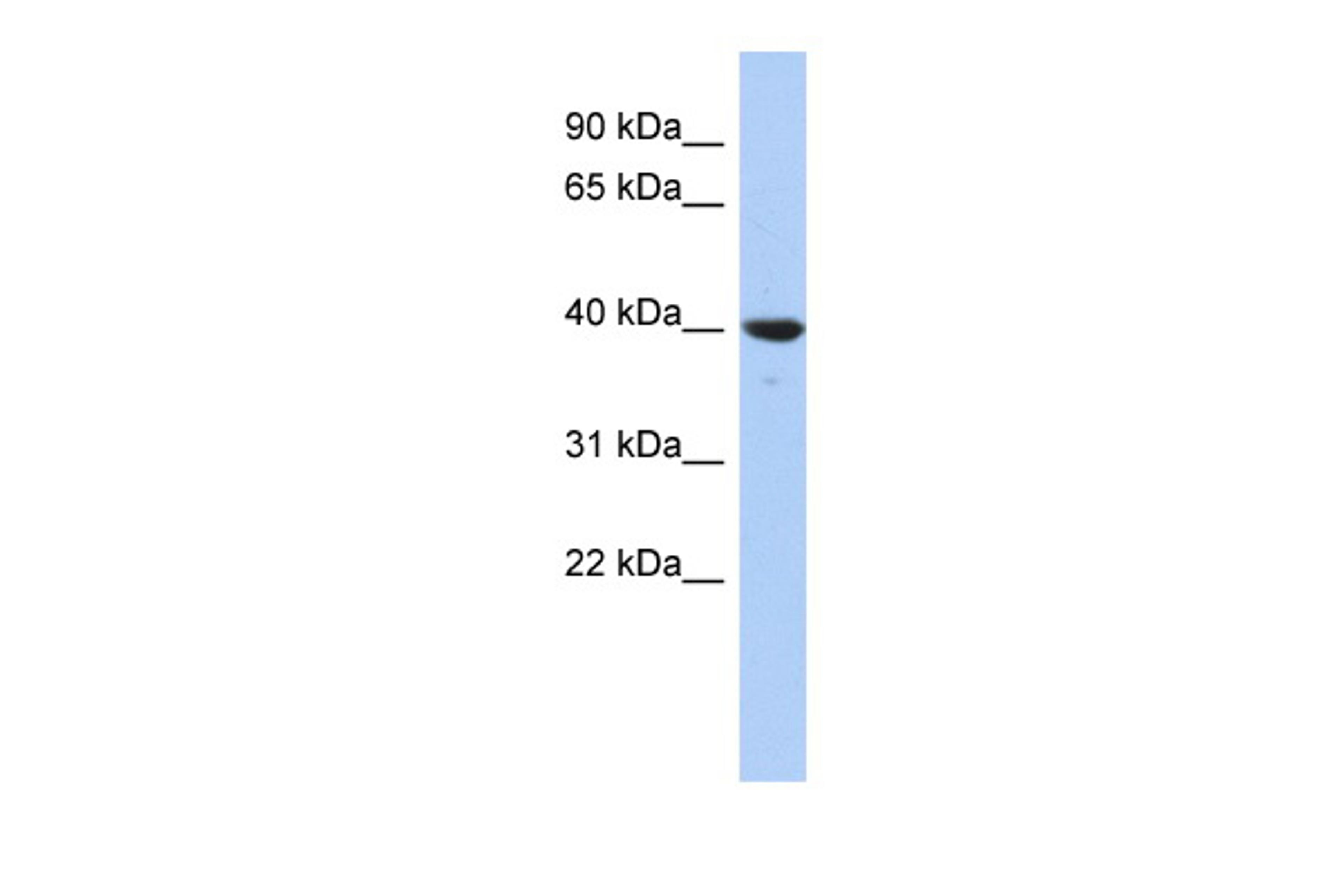 Antibody used in WB on Human HepG2 cells at 0.2-1 ug/ml.