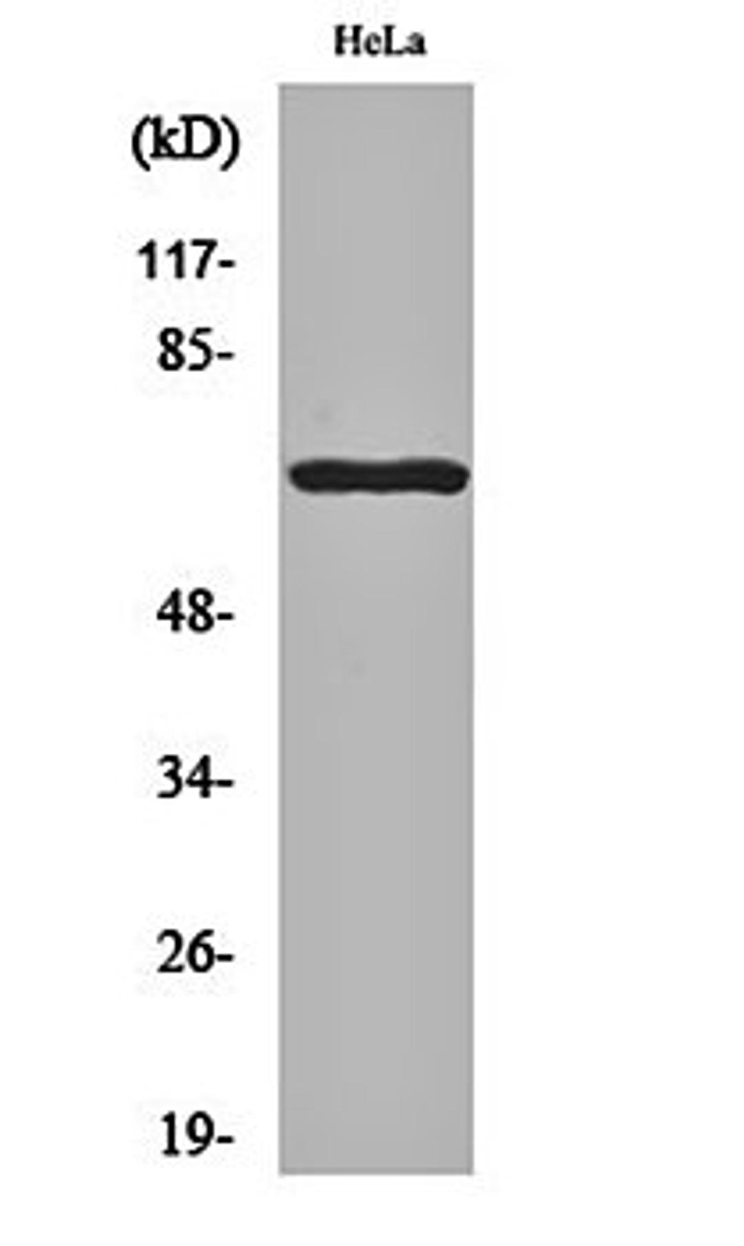 Western blot analysis of Hela cell lysates using Paxillin (phospho-Y118) antibody