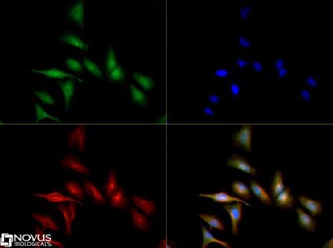 Immunocytochemistry/Immunofluorescence: Abhd5 Antibody [NB110-41576] - Abhd5 antibody was tested in Hela cells with DyLight 488 (green). Nuclei and alpha-tubulin were counterstained with DAPI (blue) and Dylight 550 (red).