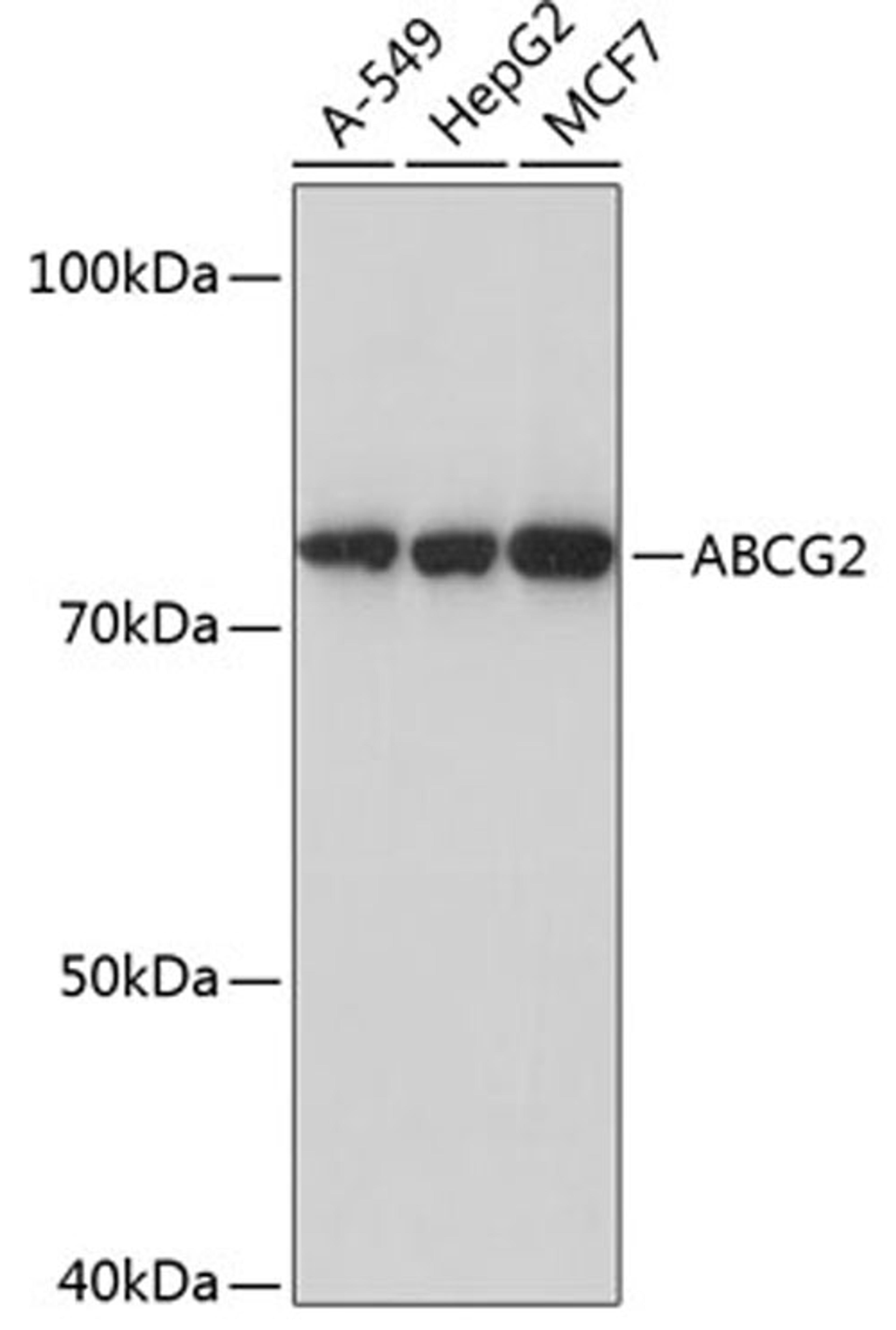 Western blot - ABCG2 antibody (A17908)