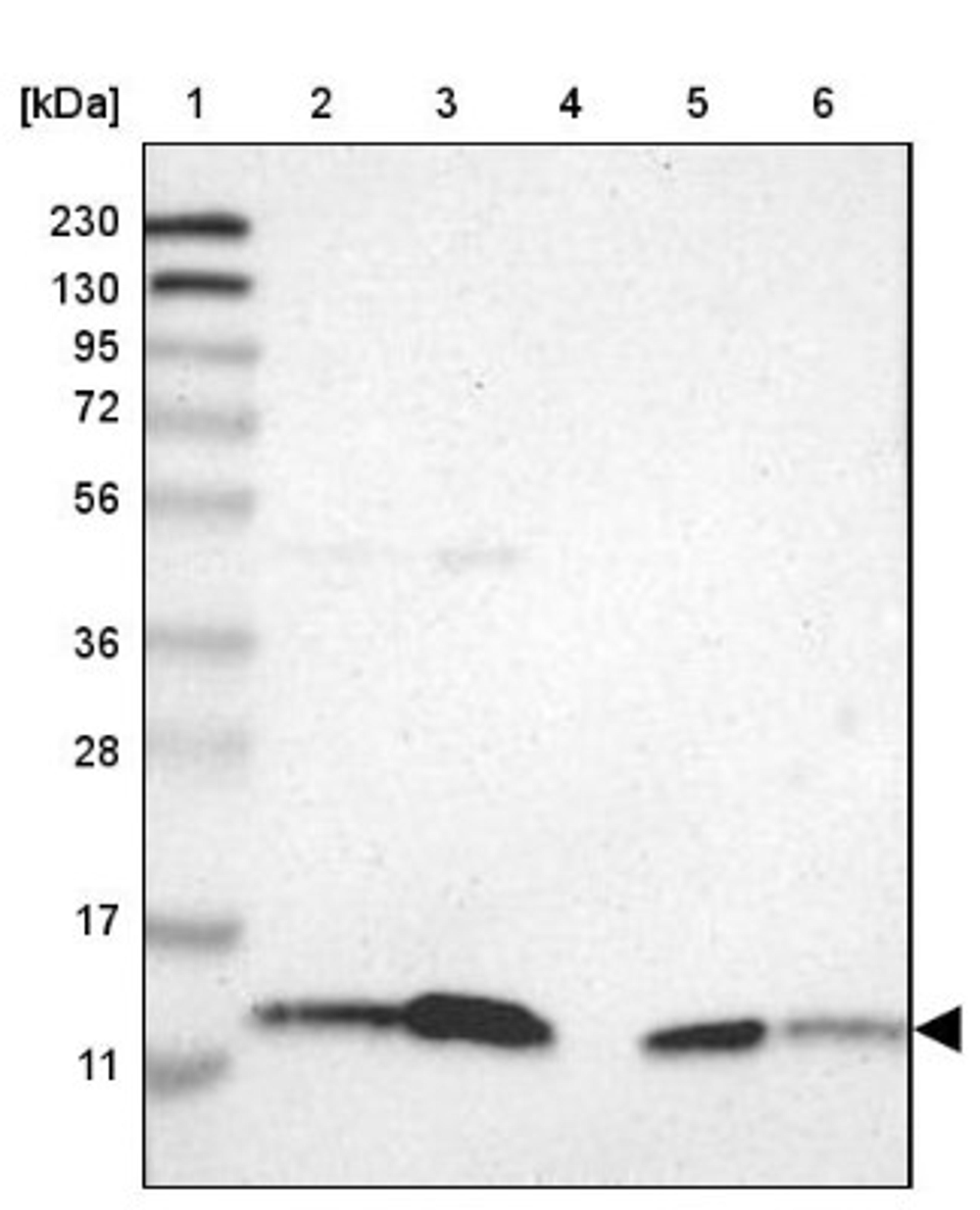 Western Blot: SELK Antibody [NBP1-86120] - Lane 1: Marker [kDa] 230, 130, 95, 72, 56, 36, 28, 17, 11<br/>Lane 2: Human cell line RT-4<br/>Lane 3: Human cell line U-251MG sp<br/>Lane 4: Human plasma (IgG/HSA depleted)<br/>Lane 5: Human liver tissue<br/>Lane 6: Human tonsil tissue