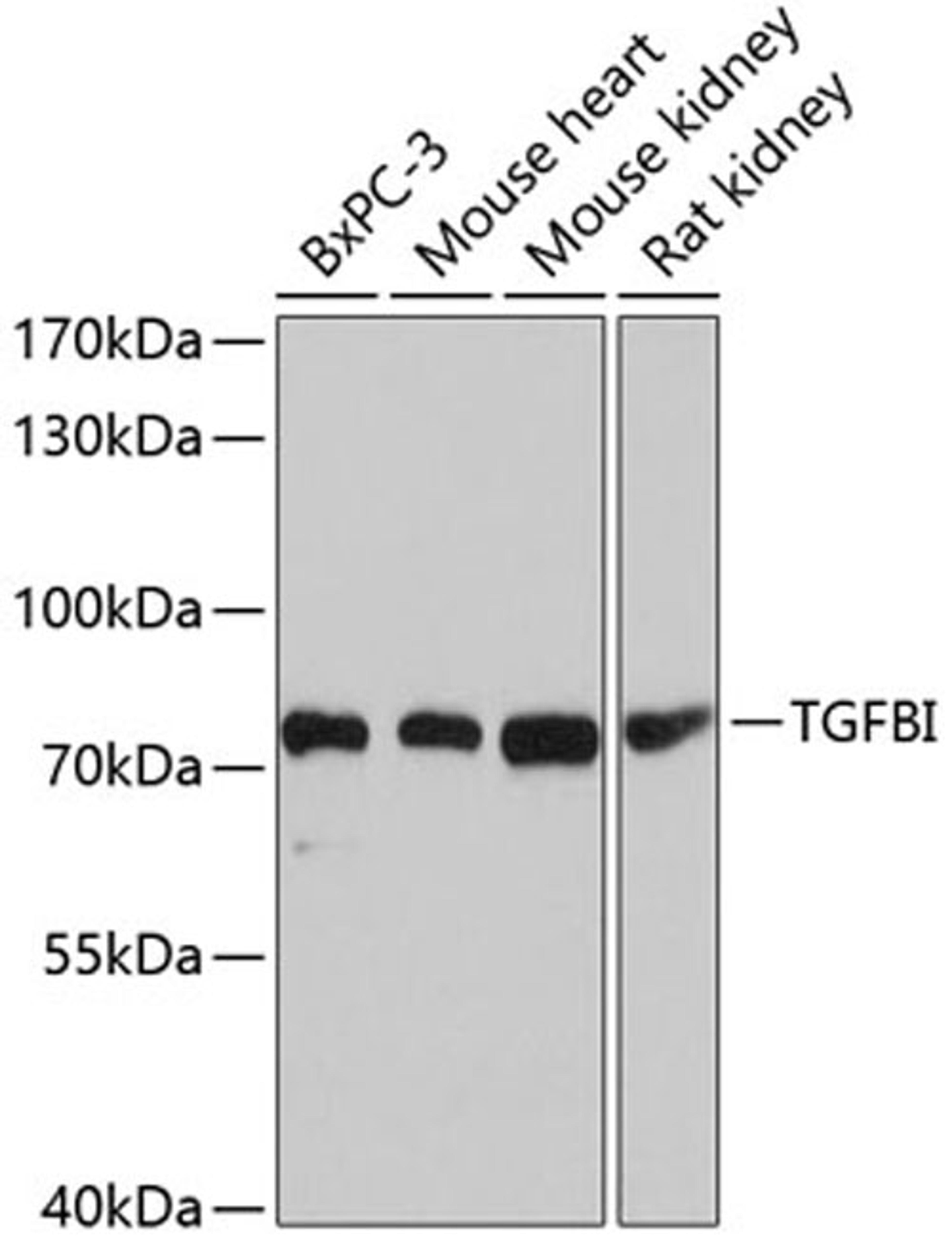 Western blot - TGFBI antibody (A2561)