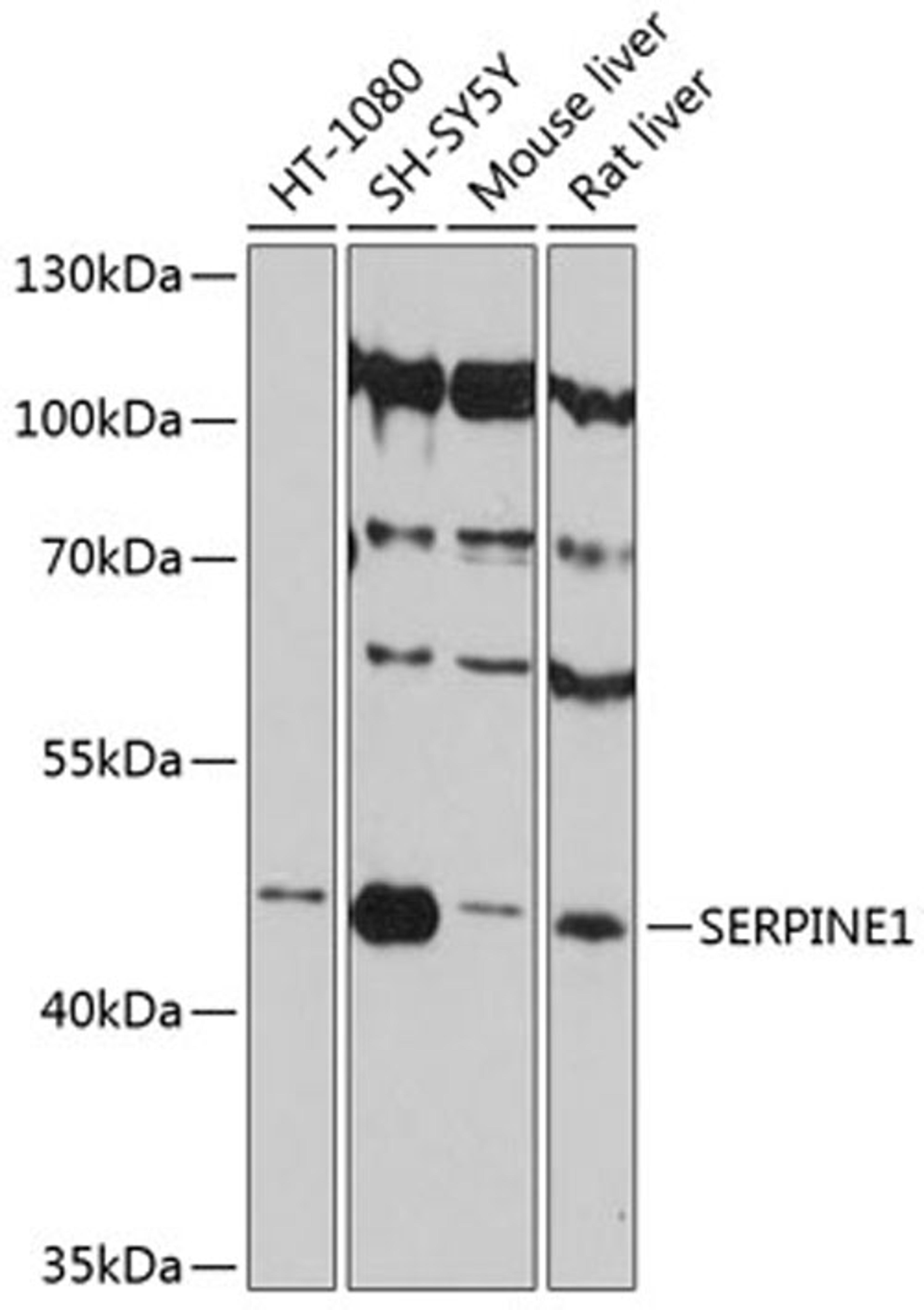 Western blot - SERPINE1 antibody (A12102)