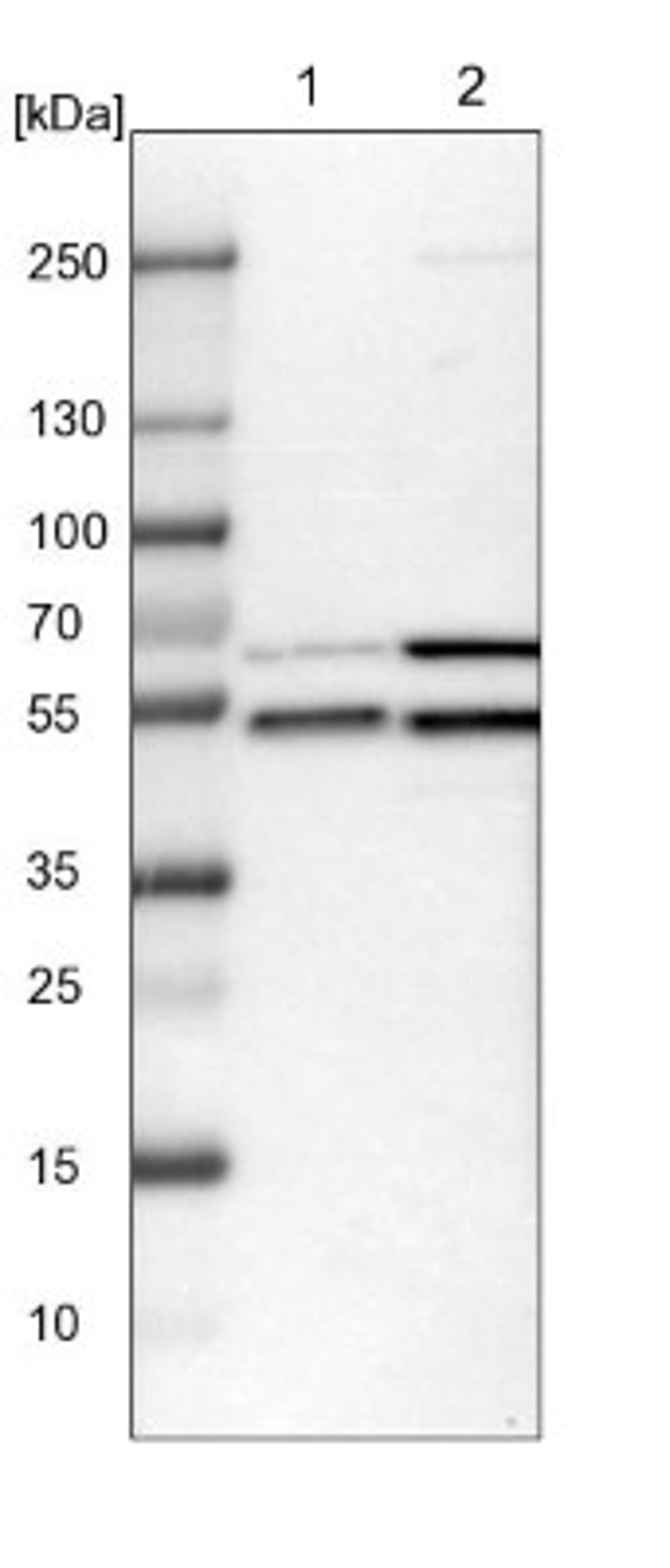 Western Blot: WIPI2 Antibody [NBP1-88879] - Lane 1: NIH-3T3 cell lysate (Mouse embryonic fibroblast cells)<br/>Lane 2: NBT-II cell lysate (Rat Wistar bladder tumour cells)