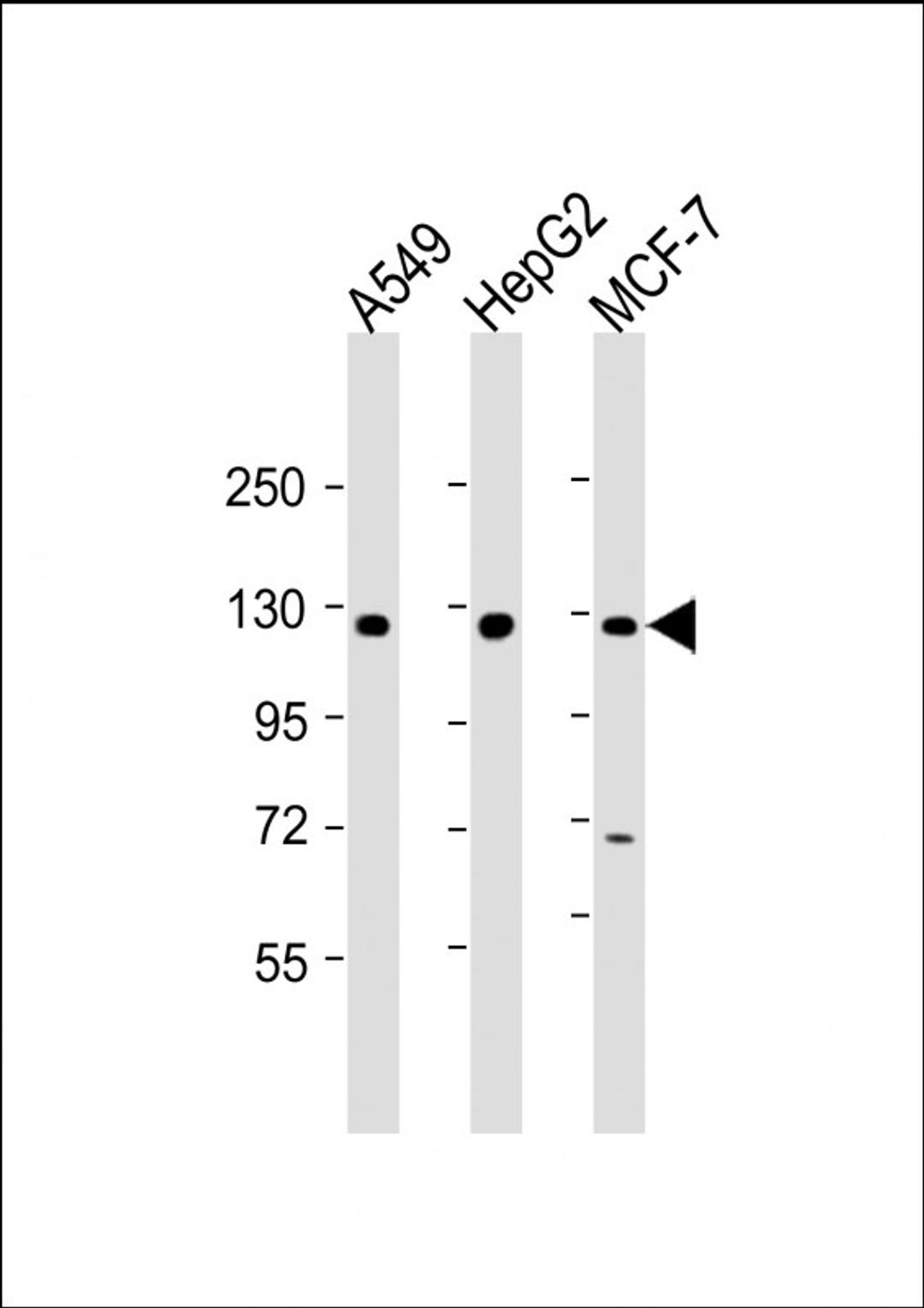 Western Blot at 1:2000 dilution Lane 1: A549 whole cell lysate Lane 2: HepG2 whole cell lysate Lane 3: MCF-7 whole cell lysate Lysates/proteins at 20 ug per lane.