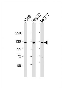 Western Blot at 1:2000 dilution Lane 1: A549 whole cell lysate Lane 2: HepG2 whole cell lysate Lane 3: MCF-7 whole cell lysate Lysates/proteins at 20 ug per lane.