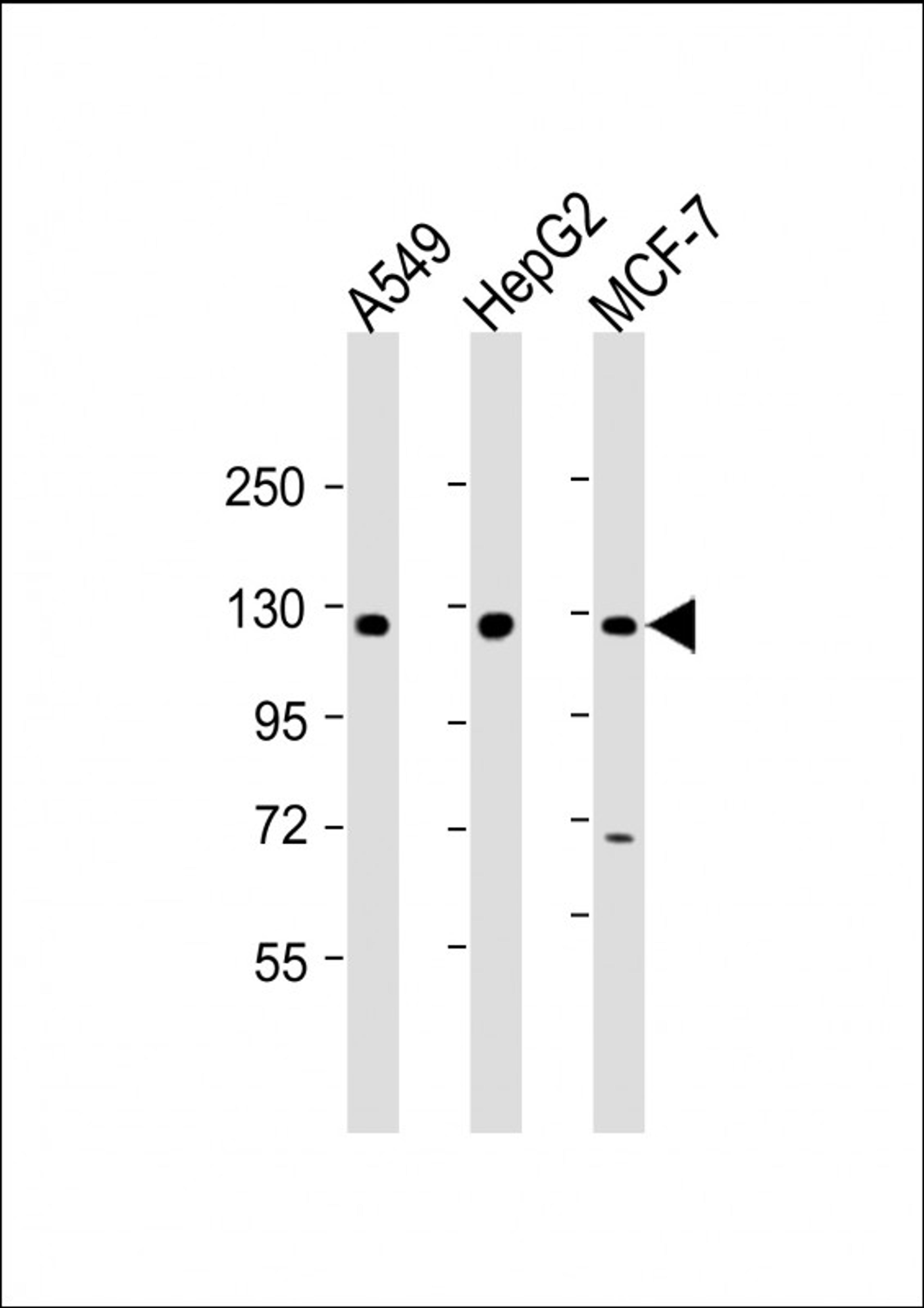 Western Blot at 1:2000 dilution Lane 1: A549 whole cell lysate Lane 2: HepG2 whole cell lysate Lane 3: MCF-7 whole cell lysate Lysates/proteins at 20 ug per lane.