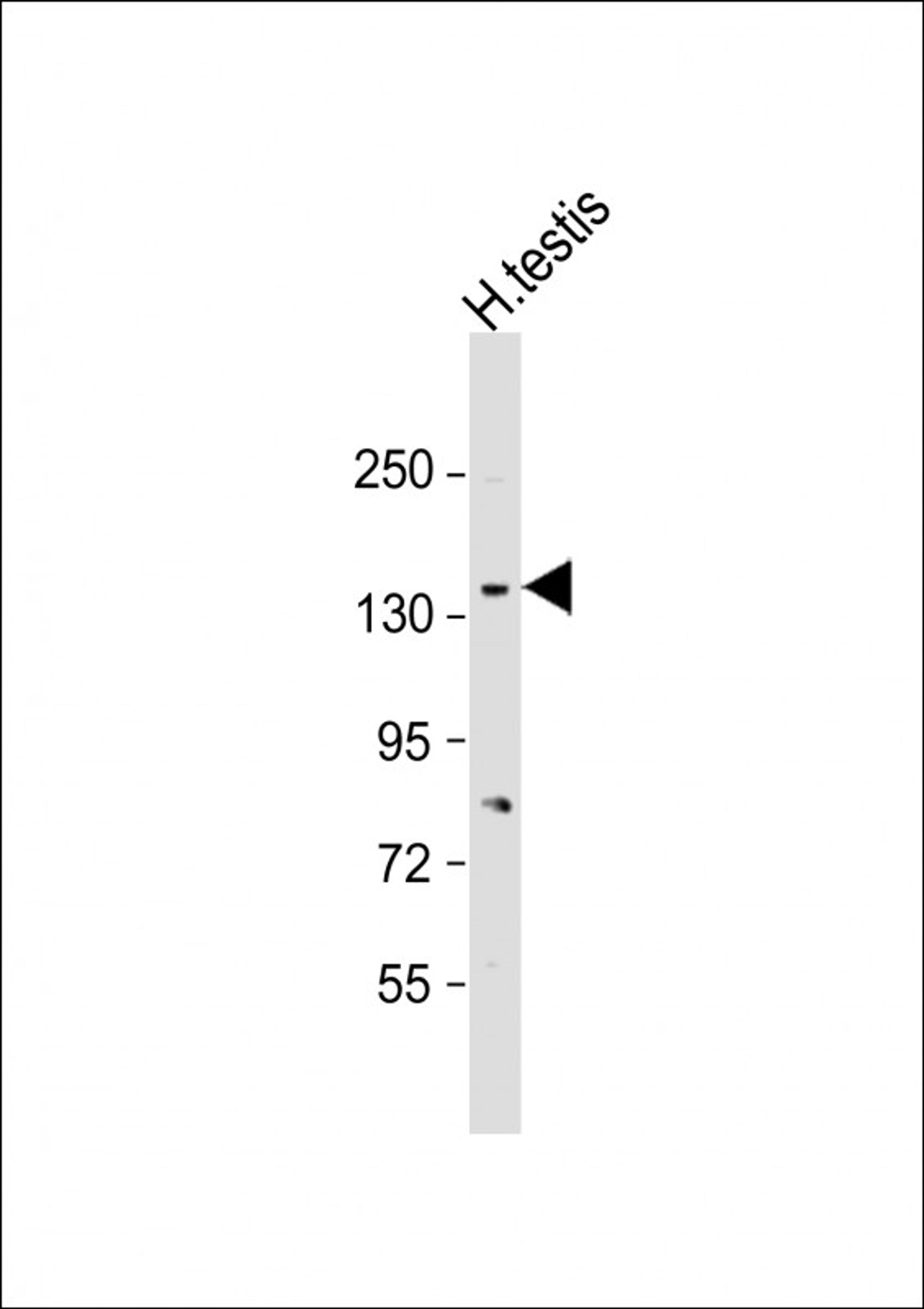 Western Blot at 1:2000 dilution + human testis lysate Lysates/proteins at 20 ug per lane.