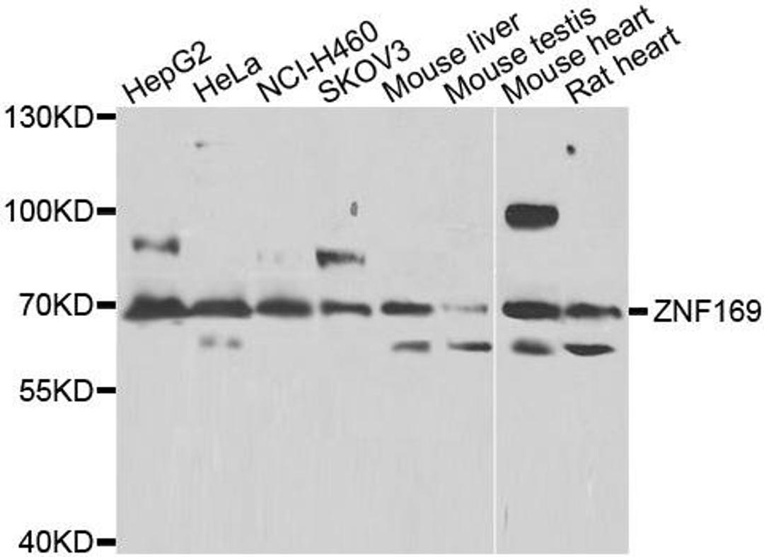 Western blot analysis of extracts of various cell lines using ZNF169 antibody