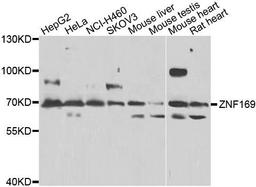 Western blot analysis of extracts of various cell lines using ZNF169 antibody