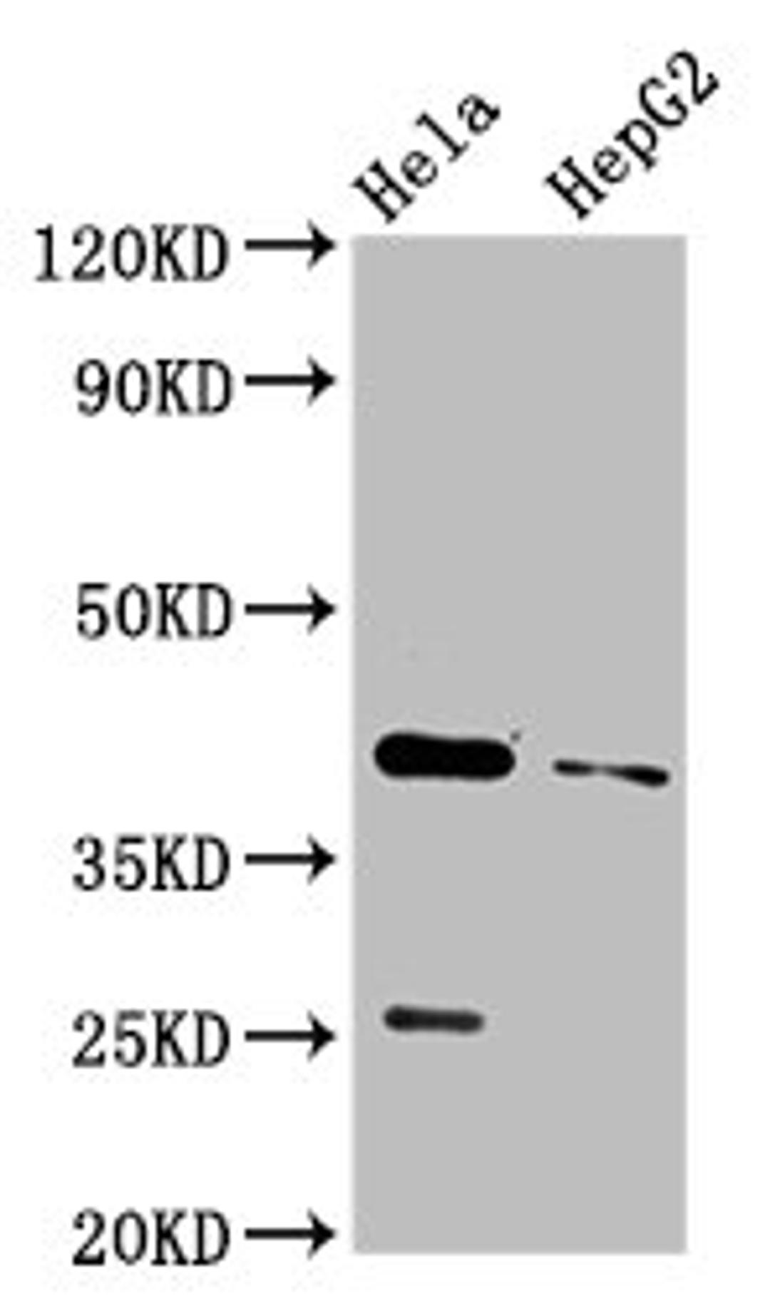 Western Blot. Positive WB detected in: Hela whole cell lysate, HepG2 whole cell lysate. All lanes: CD72 antibody at 3.2µg/ml. Secondary. Goat polyclonal to rabbit IgG at 1/50000 dilution. Predicted band size: 41 kDa. Observed band size: 41 kDa