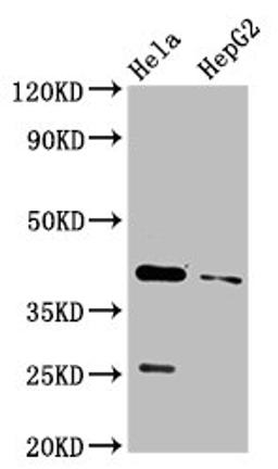 Western Blot. Positive WB detected in: Hela whole cell lysate, HepG2 whole cell lysate. All lanes: CD72 antibody at 3.2µg/ml. Secondary. Goat polyclonal to rabbit IgG at 1/50000 dilution. Predicted band size: 41 kDa. Observed band size: 41 kDa