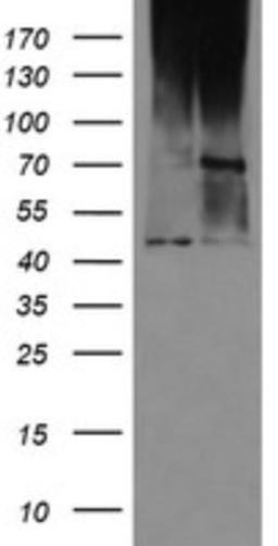 Western Blot: MAB21L3 Antibody (2A3) [NBP2-46598] - Analysis of HEK293T cells were transfected with the pCMV6-ENTRY control (Left lane) or pCMV6-ENTRY MAB21L3.