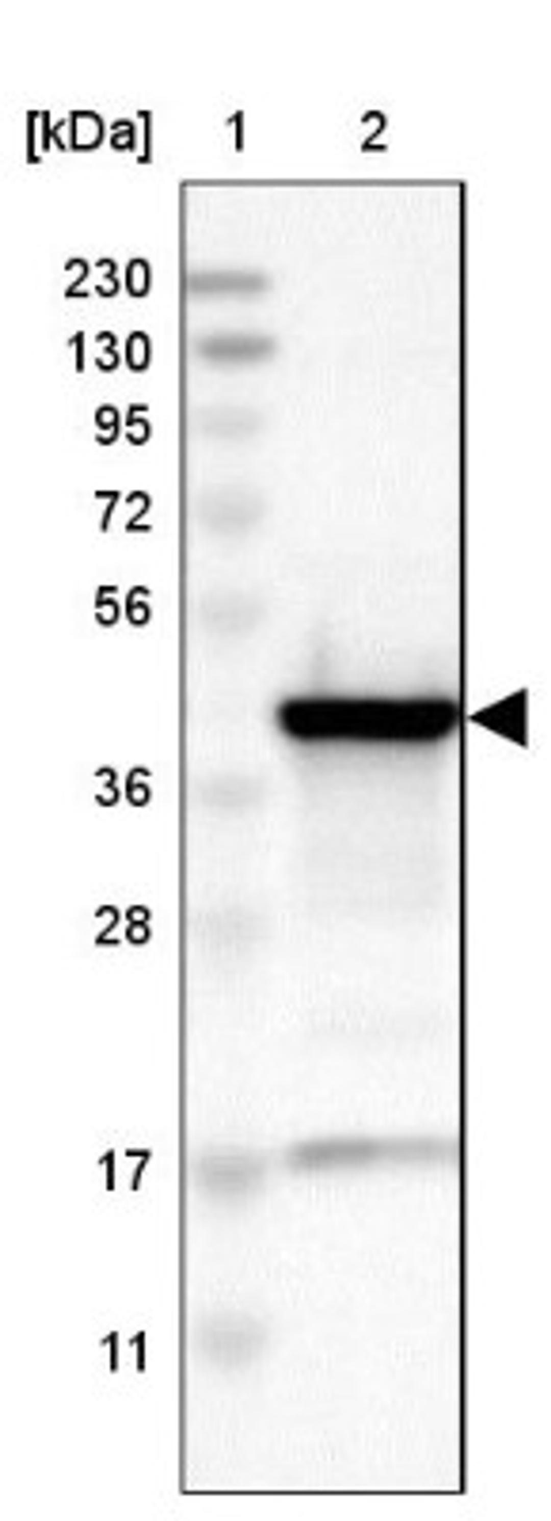 Western Blot: ACAA1 Antibody [NBP1-85786] - Lane 1: Marker [kDa] 230, 130, 95, 72, 56, 36, 28, 17, 11<br/>Lane 2: Human cell line RT-4