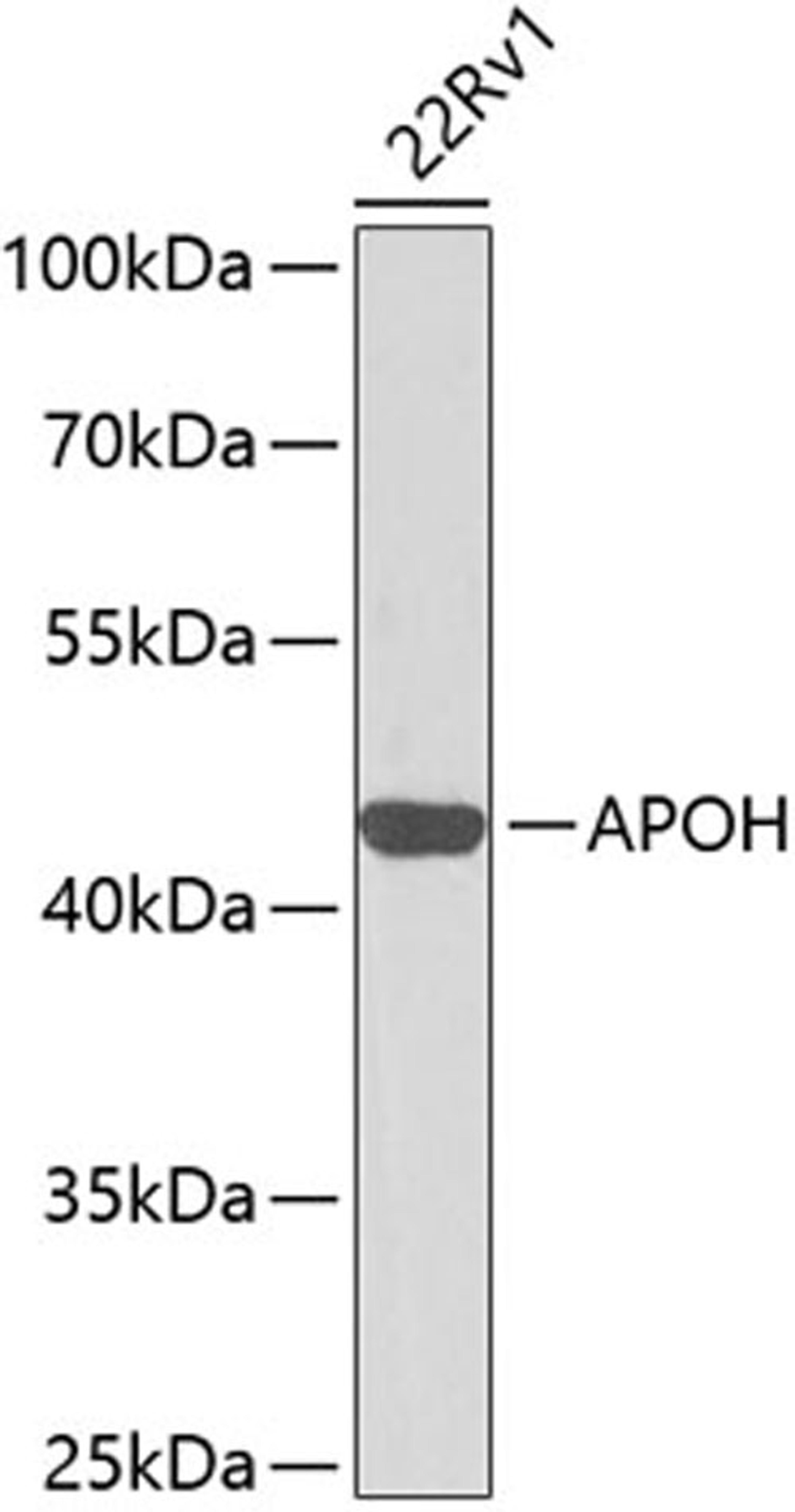 Western blot - APOH antibody (A1220)