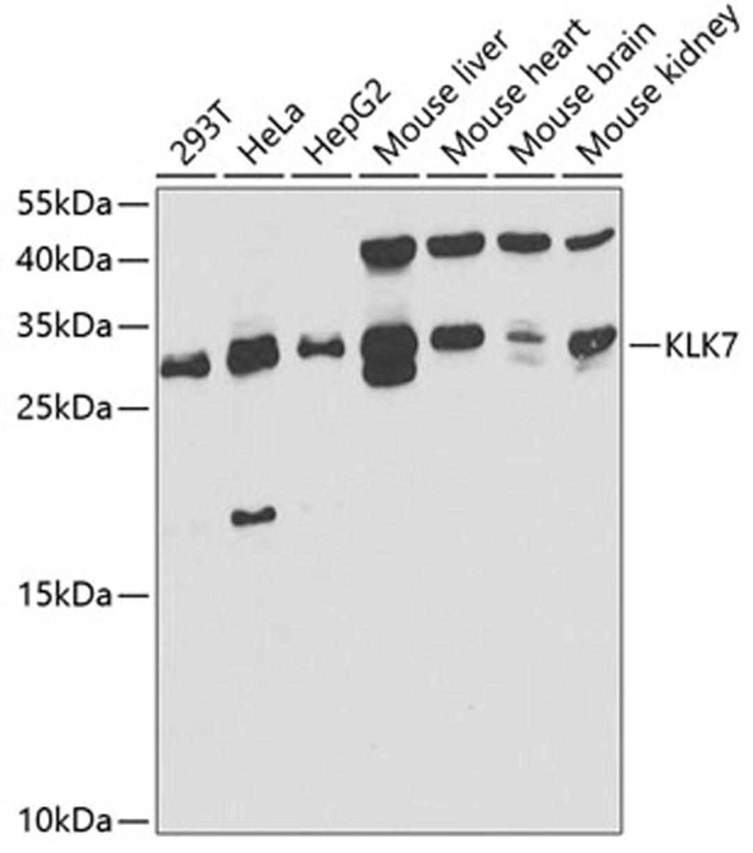 Western blot - KLK7 antibody (A5506)