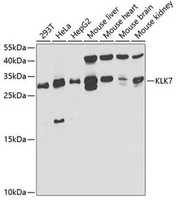 Western blot - KLK7 antibody (A5506)