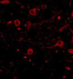 Immunocytochemistry/Immunofluorescence: CADPS Antibody [NBP1-77323] - Immunofluorescence of CAPS1 in human brain tissue with CAPS1 antibody at 20 ug/mL.