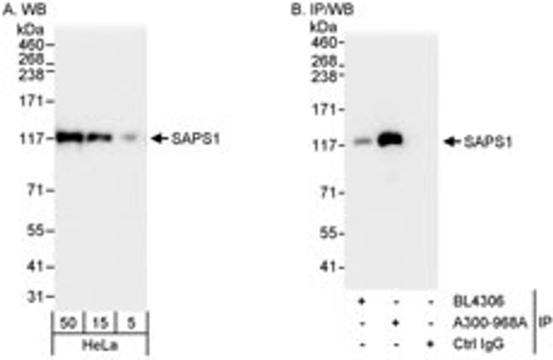 Detection of human SAPS1 by western blot and immunoprecipitation.