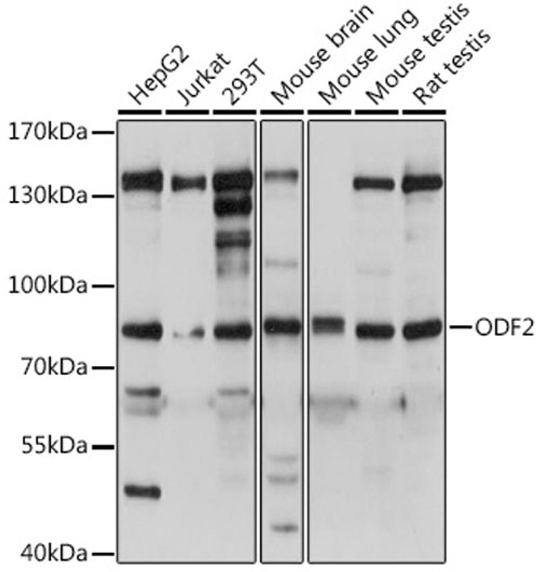 Western blot - ODF2 antibody (A15630)