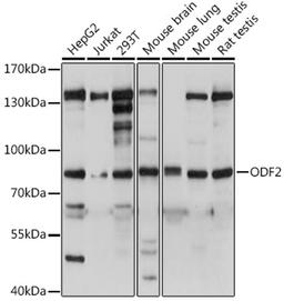 Western blot - ODF2 antibody (A15630)