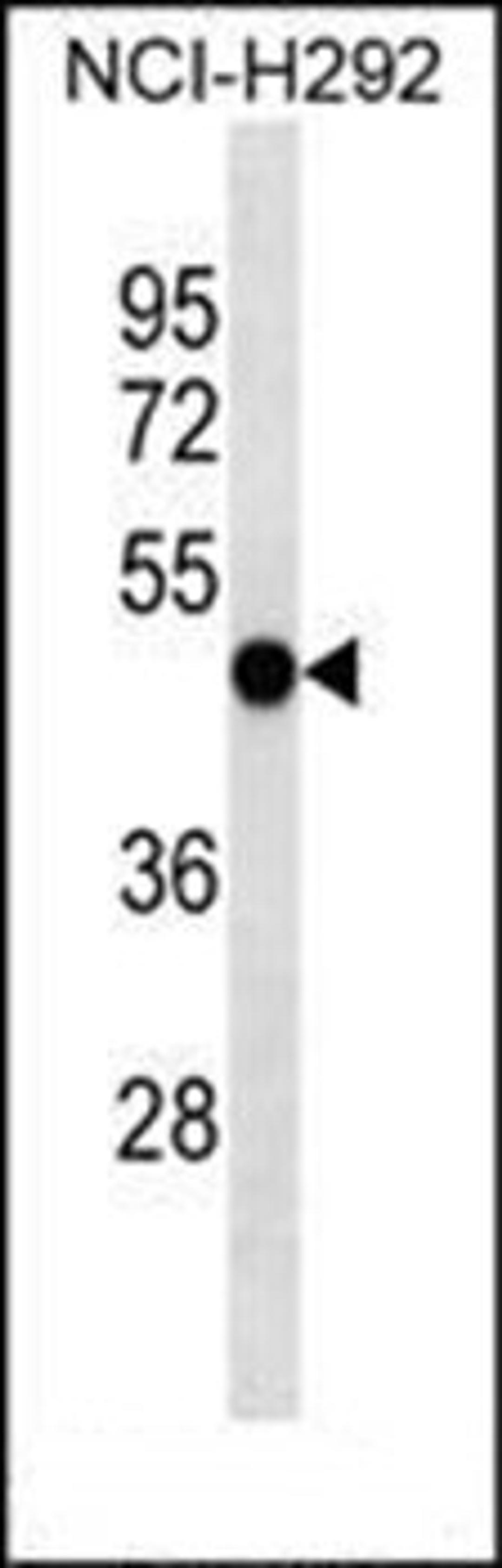 Western blot analysis of NCI-H292 cell line lysates (35ug/lane) using EIF2S3 antibody (C-term)