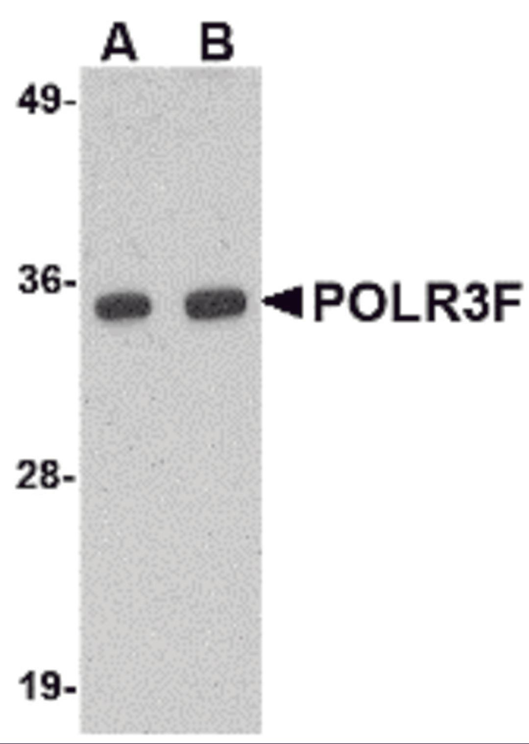Western blot analysis of POLR3F in human brain tissue lysate with POLR3F antibody at (A) 0.5 and (B) 1 μg/mL.