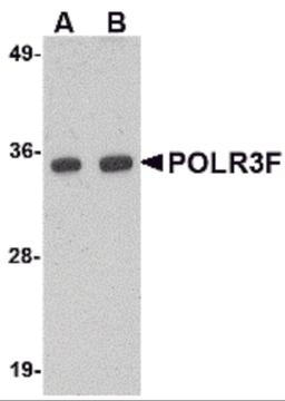 Western blot analysis of POLR3F in human brain tissue lysate with POLR3F antibody at (A) 0.5 and (B) 1 μg/mL.