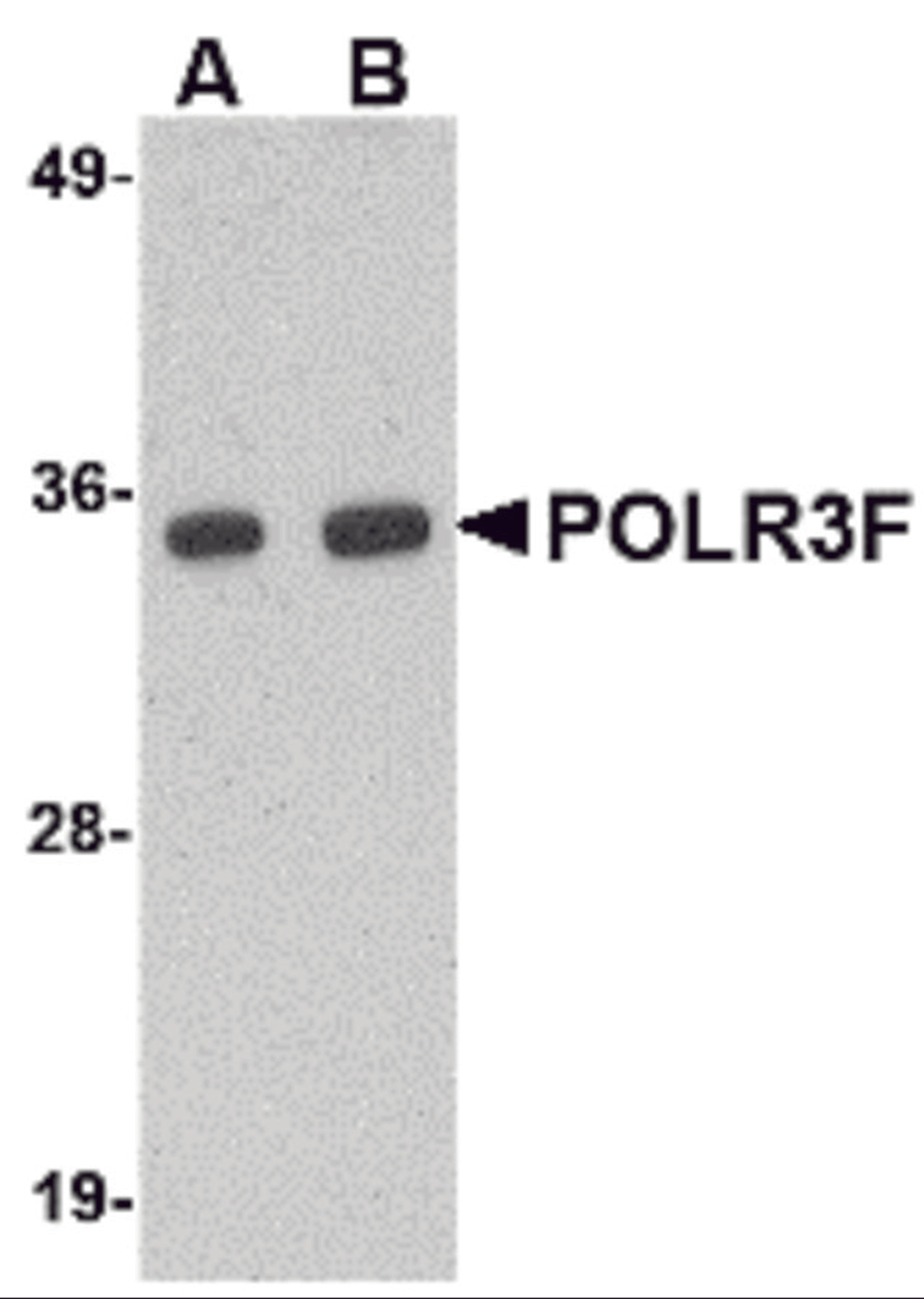Western blot analysis of POLR3F in human brain tissue lysate with POLR3F antibody at (A) 0.5 and (B) 1 μg/mL.