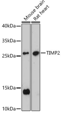 Western blot - TIMP2 antibody (A16439)