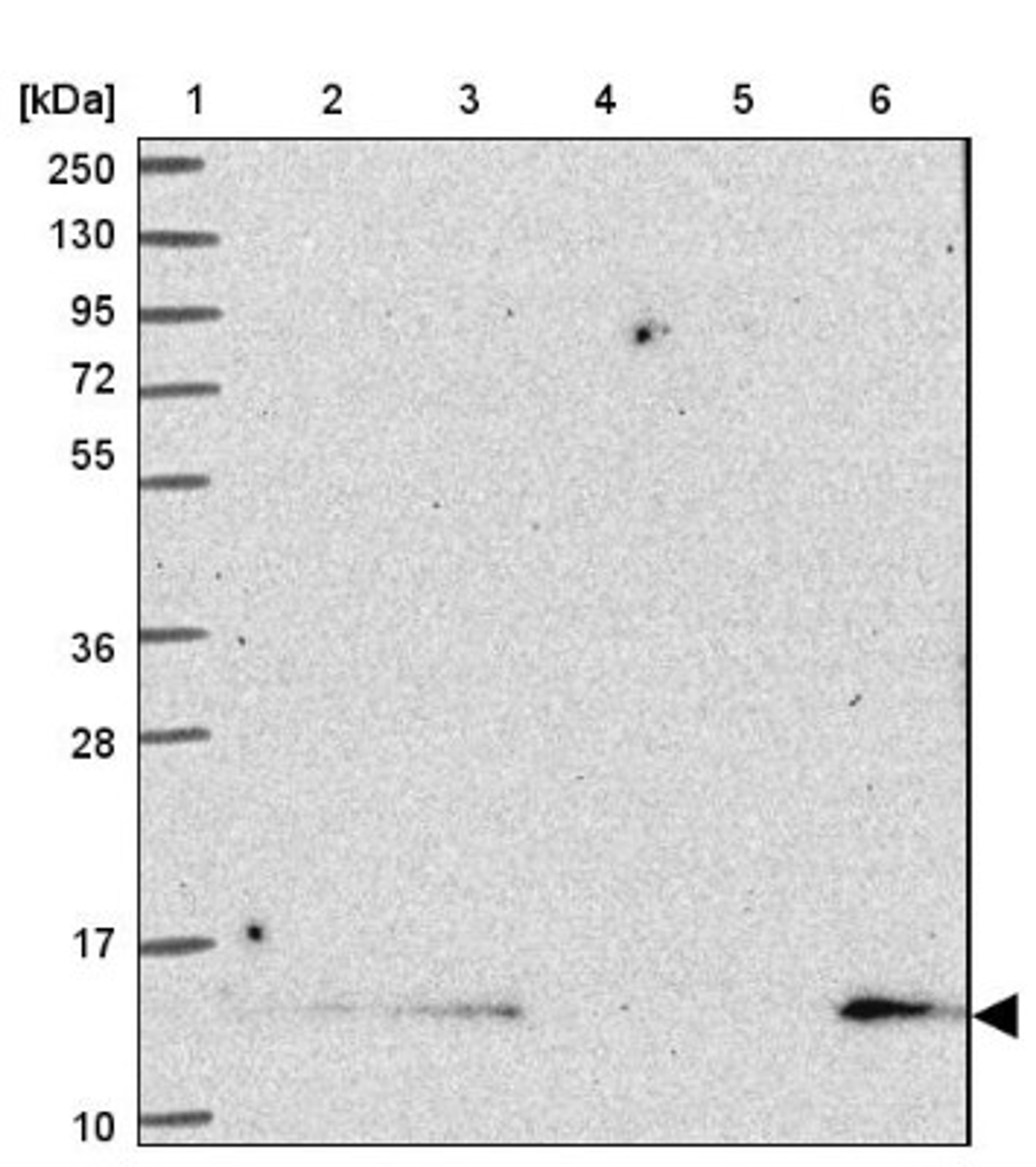 Western Blot: SH3BGRL Antibody [NBP2-33609] - Lane 1: Marker [kDa] 250, 130, 95, 72, 55, 36, 28, 17, 10<br/>Lane 2: Human cell line RT-4<br/>Lane 3: Human cell line U-251MG sp<br/>Lane 4: Human plasma (IgG/HSA depleted)<br/>Lane 5: Human liver tissue<br/>Lane 6: Human tonsil tissue