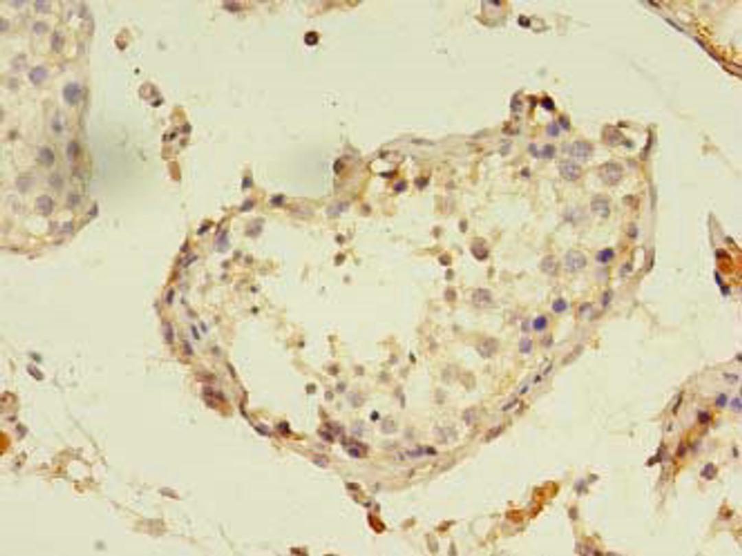 Immunohistochemistry of paraffin-embedded human testis tissue using CSB-PA017421LA01HU at dilution of 1:100