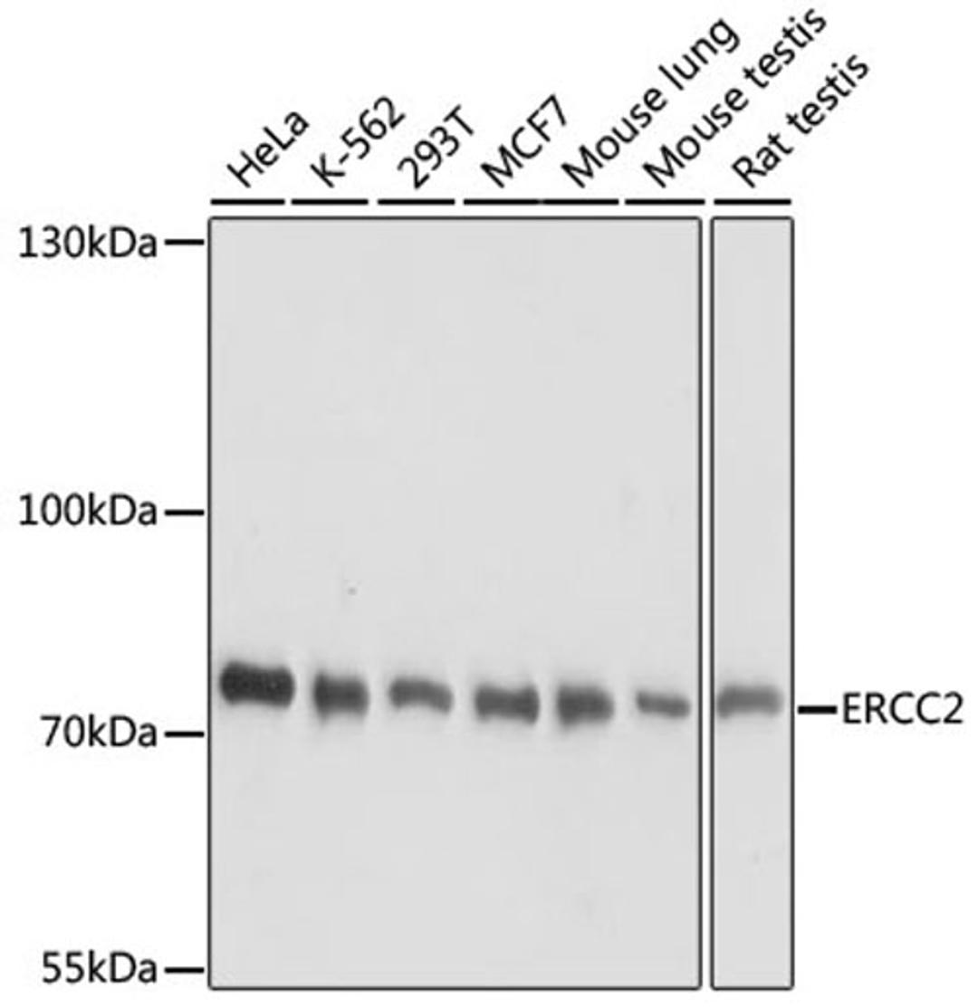 Western blot - ERCC2 antibody (A14563)